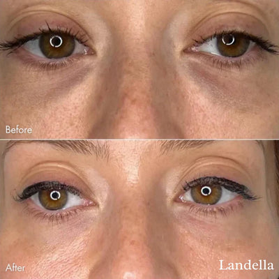 MikroAufnäher™ Entfeuchten und aufhellen