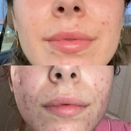 LumiGlow™ - Schmerzfreie Behandlung: Nicht-invasive Therapie