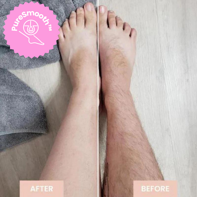 LaserSchlösser™ Stärkt die Haarwurzeln