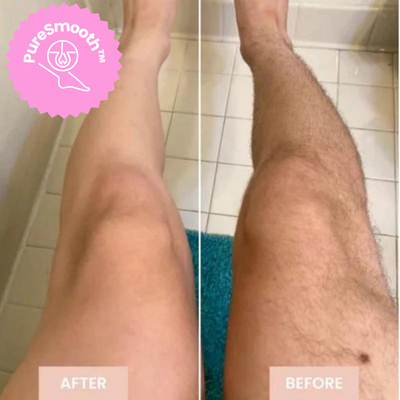 LaserSchlösser™ Stärkt die Haarwurzeln