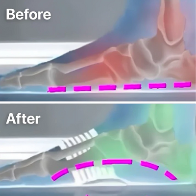 1+1 GRATIS| SchmerzPflaster™ Sofortige Entlastung der Füße