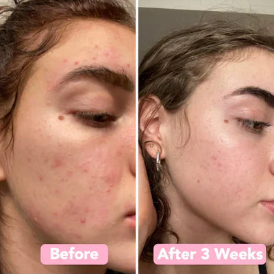 2+2 Gratis | GlanzPads™ Sanfter Strahlender Glanz