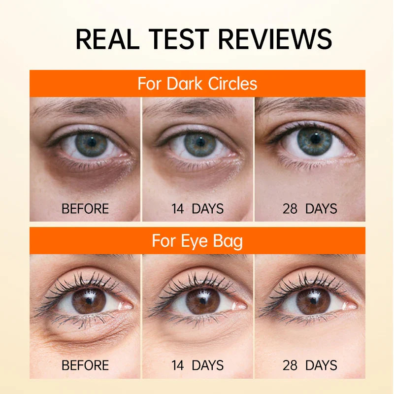 GlühendesAuge™ Dunkle Kreise reduzieren