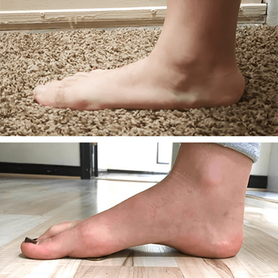 1+1 GRATIS| SchmerzPflaster™ Sofortige Entlastung der Füße