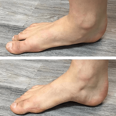 1+1 GRATIS| SchmerzPflaster™ Sofortige Entlastung der Füße