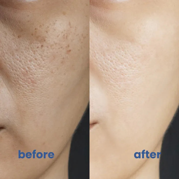 SkinMischung™ Neutralisiert sofortige Rötungen