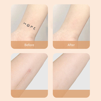 Narbenschutz™ Verstecken mit Zuversicht